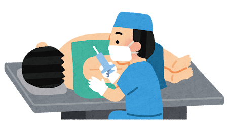 背中に麻酔の注射をしてもらうイメージ（イラスト）
