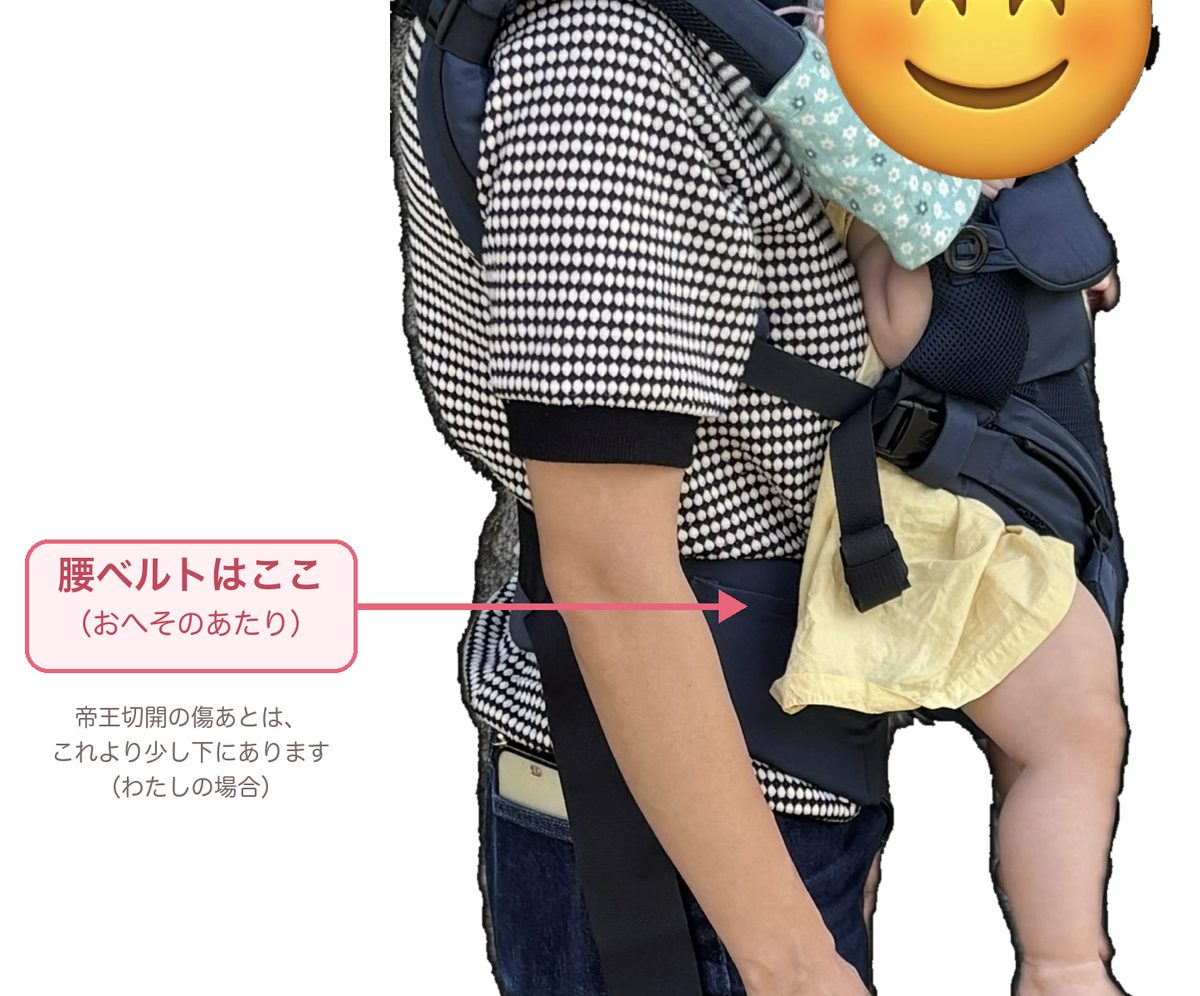 エルゴを着けて横から見たところ。腰ベルトはおへそのあたりで留めていて、帝王切開の傷あとはそれより少し下